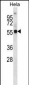 KCNA1 Antibody (Center)